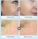 Крем против морщин для кожи вокруг глаз Veze Anti-Wrinkle Eye Cream 20 г 01205 фото 9