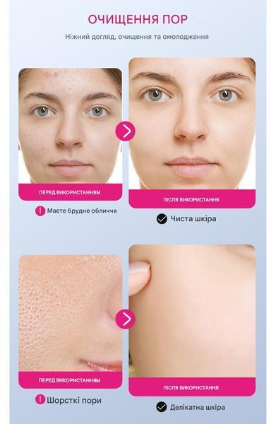 Очищающая и осветляющая пенка для умывания Sadoer Nicotinamide Arbutin White Facial Cleanser с ниацинамидом и арбутином 100 мл 01214 фото